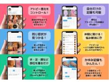 日本初のアトピー見える化アプリが「CHIBAビジコン2022」ファイナリストに選出